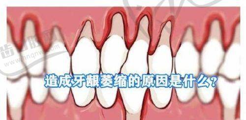 维密金雕治疗馒化脸好吗？精准、安全、恢复快，多类面部问题修复优势揭秘！