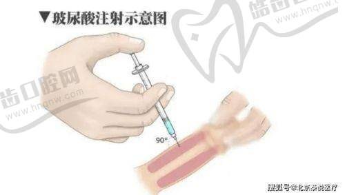 韩国登腾种植牙使用寿命揭秘：平均20年+质保10年，年轻人适用且属中高端档次！